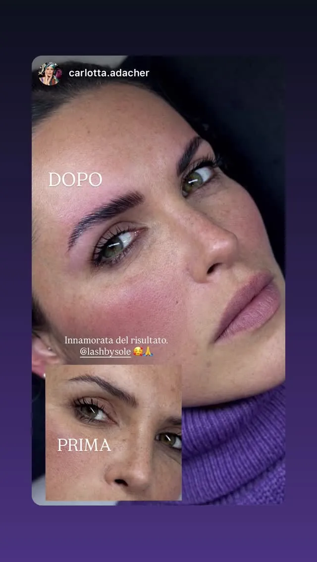 Storia di Carlotta Adacher con prima e dopo